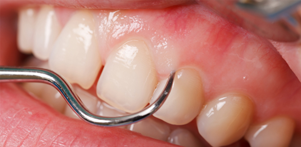 Periodontoloji
